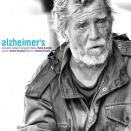 نیما کامکار Alzheimers